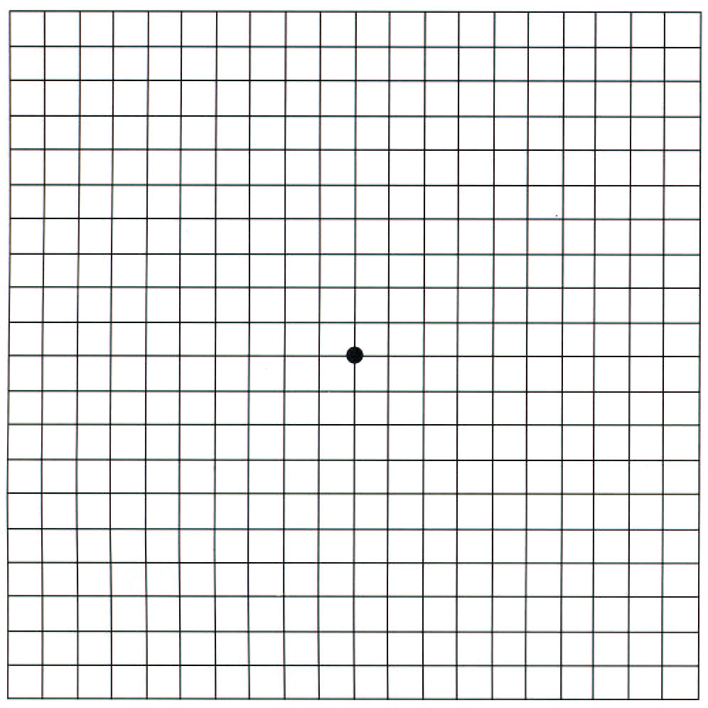 阿姆斯勒量表（Amsler Grid）